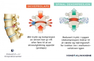 Dekompresjon og Traksjonsbehandling